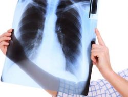 Makanan yang Membersihkan Paru-paru